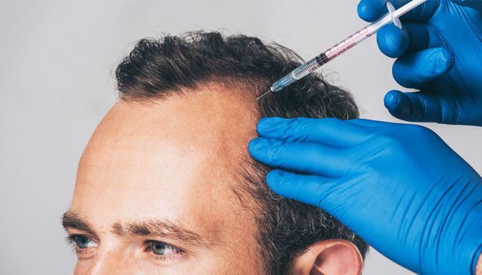 plasma therapy for hair